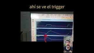 c&oacute;mo iniciar el destete de la ventilaci&oacute;n mecanica