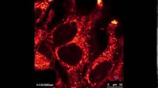 Visible light irradiation of HEK293T cells in the presence of quinolizinium photosensitizer