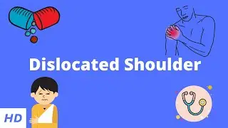 Dislocated Shoulder, Causes, Signs and Symptoms, Diagnosis and Treatment.