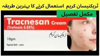 Tracnesan cream how to use | tracnesan cream review | acne treatment | tretinoin cream