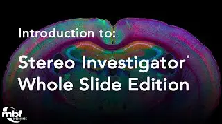 Introduction to Stereo Investigator - Whole Slide Edition