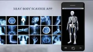 X-ray Body Scanner App