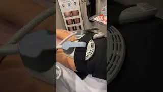 Emsculpt booty toning | 20,000 squats in 30 minutes #fatloss