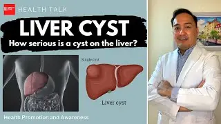 Liver cyst: How serious is a cyst on the liver?