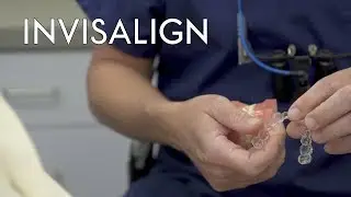 Smart Track Invisalign decreases treatment time