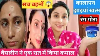 वैसलीन में यह  आधा चम्मच मिलाकर लगा लेना👉 सोते सोते स्किन गोरी टाइट चमकदार होगी😱 सांवलेपान की छुट्टी