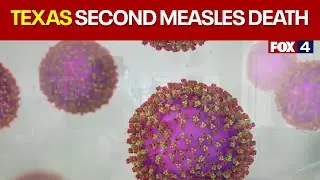 Texas' second measles death confirmed