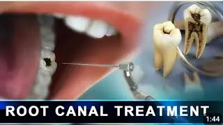 Daily Oral Hygiene 🪥🪥 Tips/Dental Problem/Symptoms Prevention treatment Hindi/Urdu
