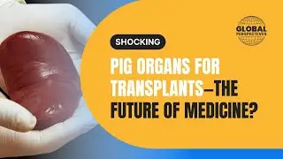 The Incredible Success of Pig Organ Transplants!