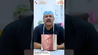 How a venous ulcer treated #venousulcer #ayurvedic #naturaltreatment