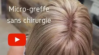 Cheveux fins : Solution indécelable / Micro-greffe sans chirurgie