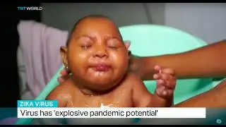 Scientists focus on explosive pandemic potential in the Zika virus