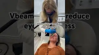 Vbeam eyelids #laser #expert #dermatologist
