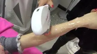 OPT SHR Hair Removal Machine Operation