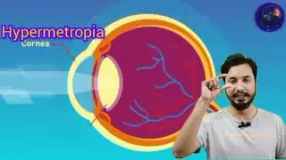 Disorders of Eye | myopia and hypermetropia @BioBrain_by_rafahkhan 