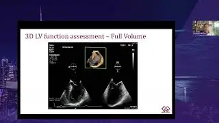 SAT 9 25 Roberto Mosca &ndash; 3D LV Volume Assessment