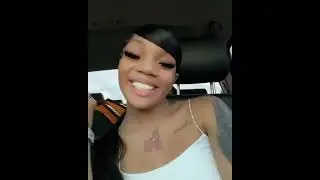 she got them teeth fix 🔥#shorts #trending #glorilla