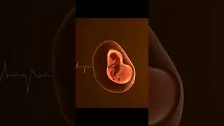 Miracle of Life #newlife​ #miracleoflife​ #baby​#pregnancy​ #fetalheartbeat​ #motherhood
