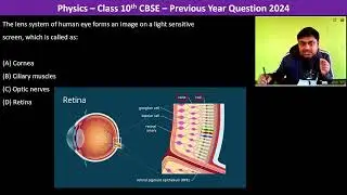 The lens system of human eye forms an image on a light sensitive screen, which is called as:(A)