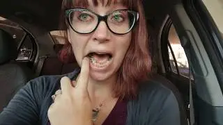 My dental bridge journey - Part 4