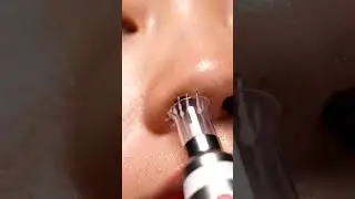 Pore Vacuum Magic: Sebum Filaments Melt Away 🤯✨ ASMR Clean