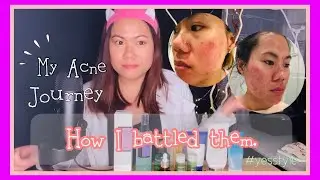 Best SkinCare for Sensitive Skin | Acne/Dark Spots/Acne Scars | YesStyle Review #YesstyleHELLO2021