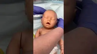 Neonatal head circumference