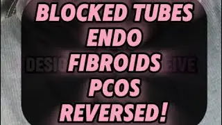 Blocked Tubes, Endo, Fibroids? You Can Heal Naturally with the FTF System