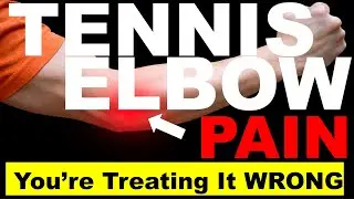 Tennis Elbow Pain But I Dont Play Tennis! #tenniselbow #elbowpainphysio #painrelief