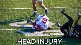 Kobe Prentice Suffers Head Injury Against Vanderbilt.