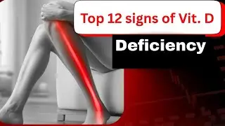 12 signes alarmants de carence en vitamine D | &Agrave; ne jamais ignorer