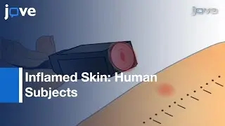 Determining Heat & Mechanical Pain Threshold Inflamed Skin: Human Subjects l Protocol Preview
