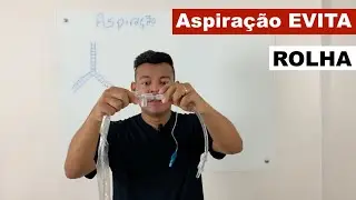 Você sabia que a má ASPIRAÇÃO do paciente causa ROLHA?