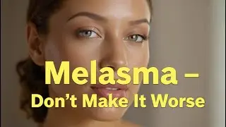 🌞 Melasma Treatment Tips: Don’t Make It Worse!