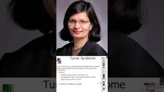 Explore essential insights on #TurnerSyndrome and #puberty!