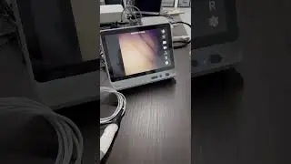 1.8mm Flexible Endoscope with 14.1 Inch Display