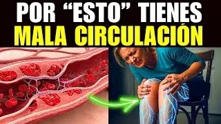La VERDADERA Causa de la MALA CIRCULACIÓN (Insuficiencia Venosa)