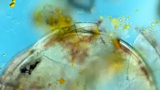 Holophyra and Ostracod - A Painted Scene