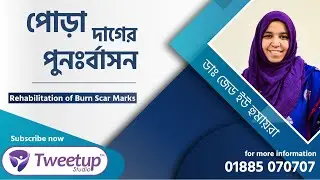 পোড়া দাগের পুনঃর্বাসন-Rehabilitation of burn scar marks [4K]