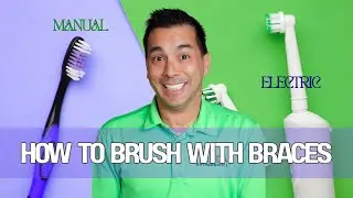How To Brush with Braces | Manual vs. Electric Toothbrush
