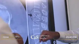 Spinal Cord Accident Injury Experts | Cordisco & Saile | The Bucks County Injury Lawyers