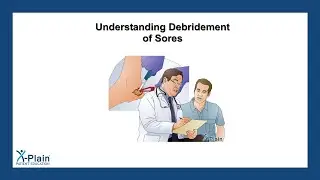 Understanding Debridement of Sores