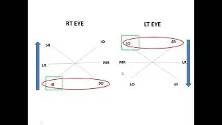 Park 3 step test