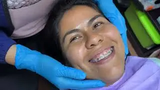 Por que me puse brakets otra vez 🇸🇻
