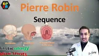 Pierre Robin Sequence - Plasticology Shots