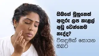 Anti-pigmentation Treatment | Spotlight