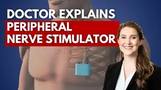 Peripheral Nerve Stimulation Explained by Dr. Allison Bell