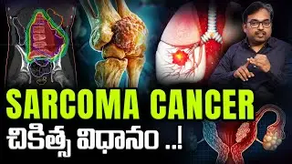 సార్కోమా క్యాన్సర్ అంటే ఏమిటి? సర్జరీ తప్పనిసరా | Sarcoma cancer telugu | Radiation therapy | Kaizen