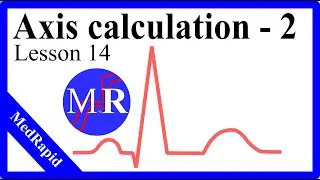 Precise Heart Axis Calculation