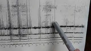 Mass Spec METASTABLES and Data Collection before Computers ... Visicorder Analog Data Collection